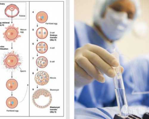 广州供卵试管婴儿中介,广州中山六院可以供卵-大航海十大ol单机
