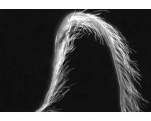 广州hiv代孕,赴美做试管：子宫肌瘤切除后，移植成功率有多少？-夫妻去广州做