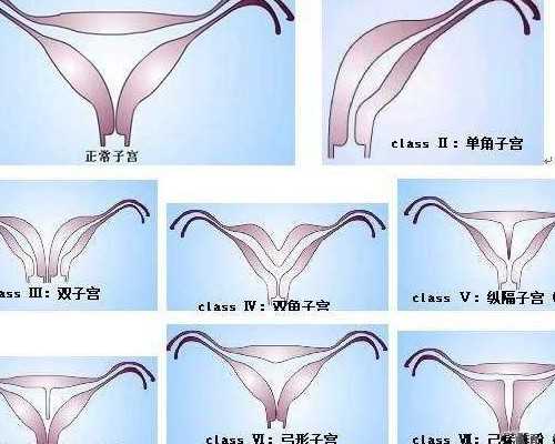 广东试管婴儿医院哪里专业？广东省做试管婴儿最好？