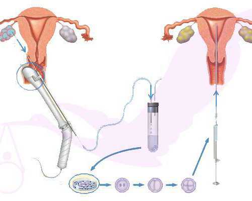 广州卵子库供卵费用清单?,广州供卵试管要求_高画质电脑单机游戏