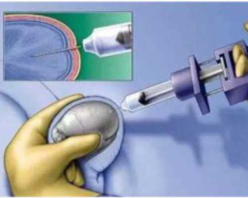 做供卵试管最好的医院&代孕地址,现在还可以做供精试管婴儿吗？备孕一年都没