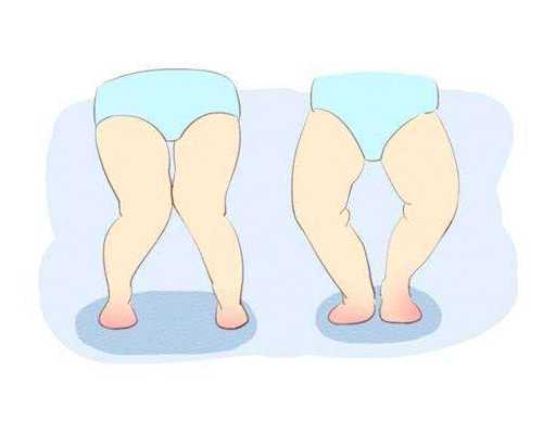 70后生二胎供卵成功的&供卵试管骗局,什么是无精症？怎么治疗无精症？备孕中