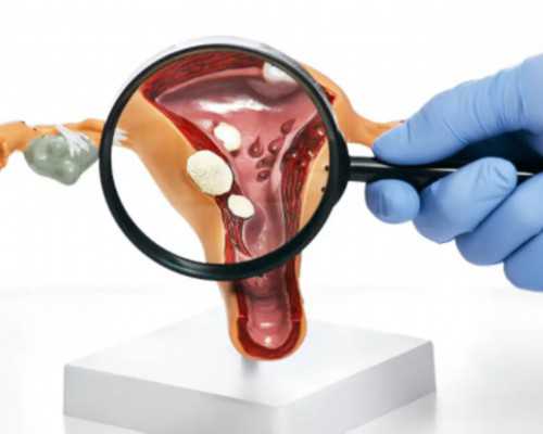 试管婴儿过程是否痛苦,人工代孕咨询