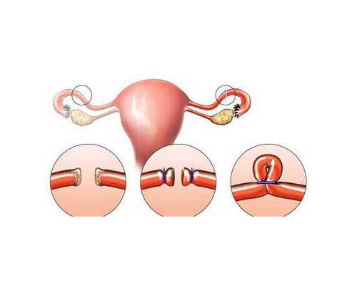 肿瘤坏死因子高对怀孕的影响,私立试管医院