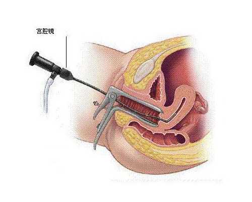 广州供卵自怀费用明细,广州供卵试管受骗经历_代怀中心包成功