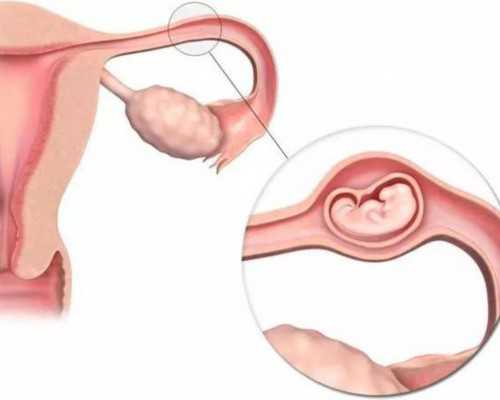 广州有做代孕的医院吗,广州供卵费用,广州地下供卵费用