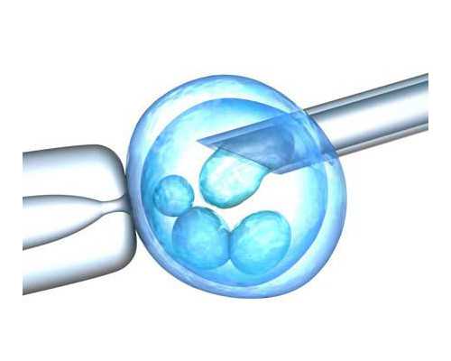 广州卵子库供卵费用清单?,广州紫朵朵供卵价格-去代怀孕靠谱吗