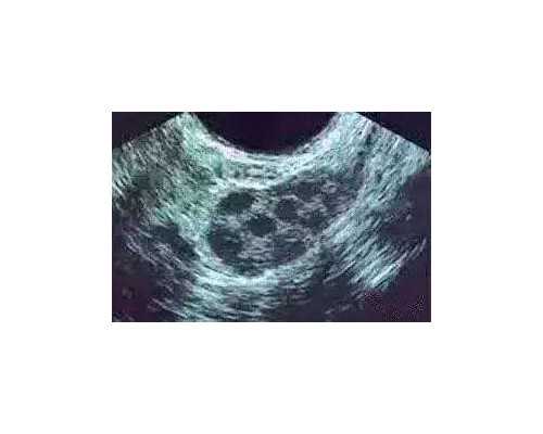 广东生殖科试管成功率多少,广东生殖科医院排名！