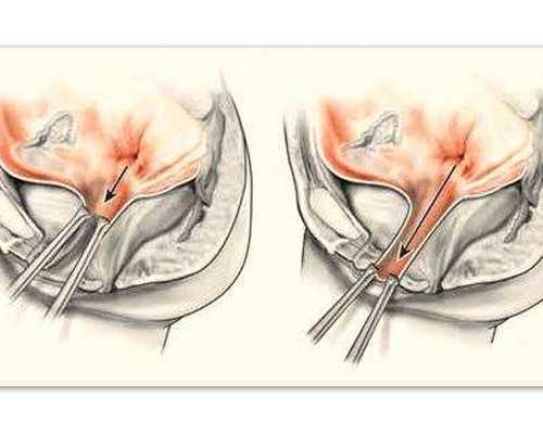 怀孕一个月测是男是女妙招，怀孕初期看是男是女小技巧,快速代怀机构