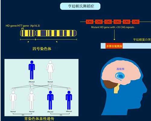 宫腔镜手术后要卧床吗