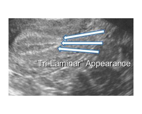 同房5到6天怀孕最明显的征兆？8个征兆说明你怀孕了？,试管供卵代生