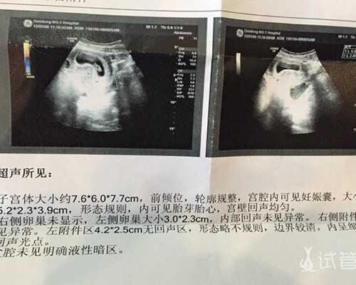 广州供卵医院地址（广州供卵医院知名十月幸孕助孕）-代孕包性别