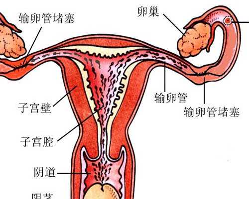 剖腹产同时切除子宫肌瘤,试管借卵代生